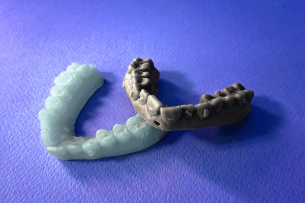 ریختگری مدل سه بعدی دندان