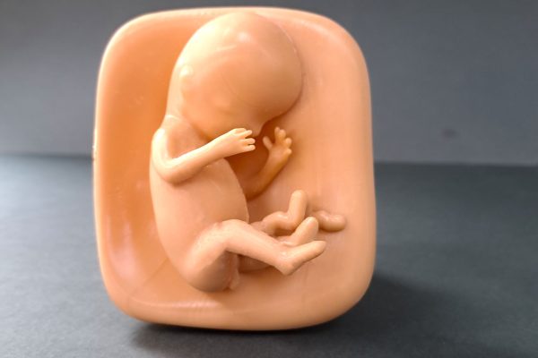 چاپ سه بعدی جنین